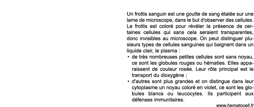  Un frottis sanguin est une goutte de sang  tal e sur une lame de microscope, dans le but d'observer des cellules  Le   