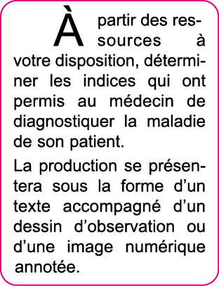   partir des ressources   votre disposition, d terminer les indices qui ont permis au m decin de diagnostiquer la mal   