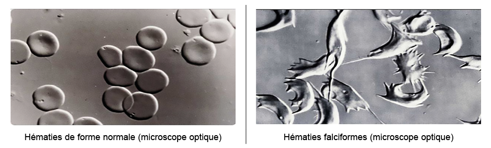  , ,H maties de forme normale (microscope optique),H maties falciformes (microscope optique)